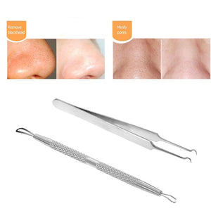 BLACKHEAD AND COMEDONE ACNE EXTRACTOR / 2PCS